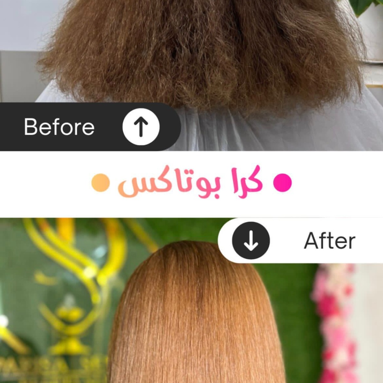 کرابوتاکس