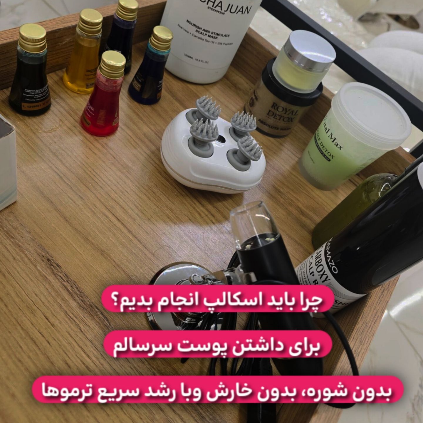اسکالپ سر